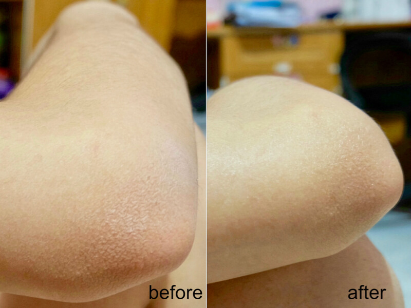 Before & after pemakaian Vaseline Advanced Strength